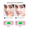 Portable Heart-Shaped Facial Massager Vibration Face Beauty Device Rechargeable Cheeks Slimmer Skin Tightening Rose Gold